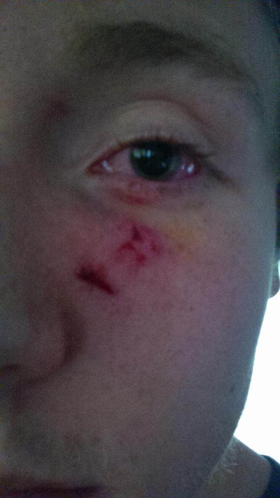 AbeRitchey's tweet photo. This is what happens when you do meth!!! http://t.co/J4I14GguPc