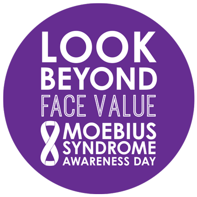 FaceEquality's tweet photo. Saturday is Moebius Syndrome Awareness Day 2015 #MSAD15 http://t.co/DmsyTKDeT5