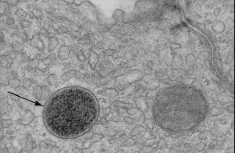 CytoCampaign's tweet photo. When you're a glorified dumpster... #Lysosomes #AHSOIC15 http://t.co/gGCZFhkxP1