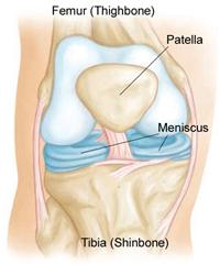 PhysioDublin's tweet photo. Here's why people shouldn't worry quite so much about damage to their knee cartilage - http://t.co/6YQlFplygX http://t.co/vOXxa5eWst