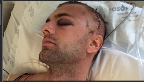 10NewsChen's tweet photo. Softball bat flies over fence, seriously injures local man @10news #SanDiego #Softball http://t.co/XRrWQXNUpm http://t.co/g6qywXg4Bf