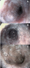 Albinovet's tweet image. dog: lacteal involvement in lymphoplasmacytic #enteritis correlates with  hypoalbuminemia goo.gl/4BtzRZ