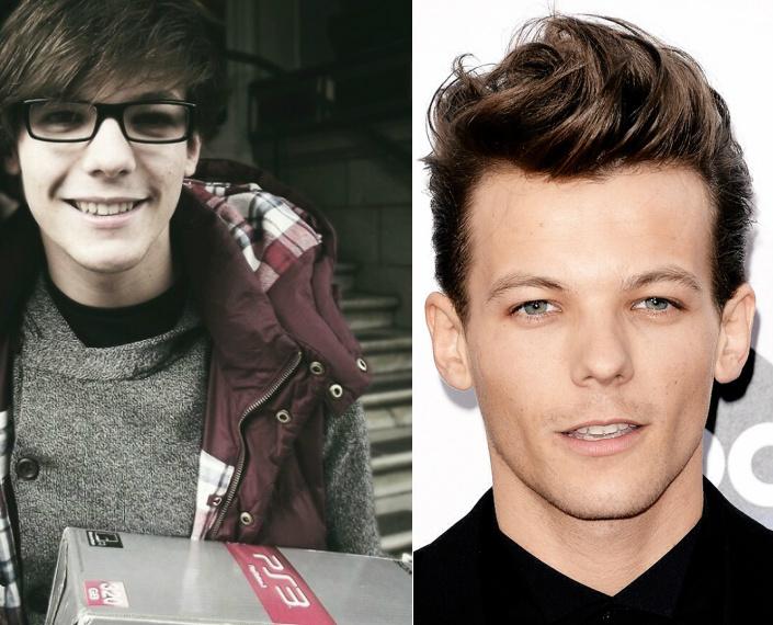 divstant's tweet image. 'celebrità prima e dopo'

LOUIS TOMLINSON