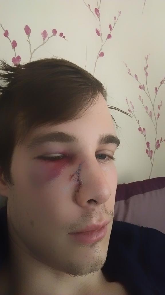 rsmonkman's tweet photo. @BarrieDuffill @FcRidings @malreeves64 @markreeves22 @druryboy30 @MarkReeves25 feeling fresh this monrning @samnormy http://t.co/V0z05gZG1Q