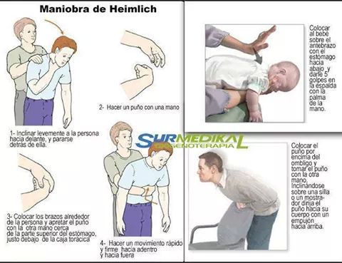 Podemos ayudar a salvar una vida.Maniobra de Heimlich.