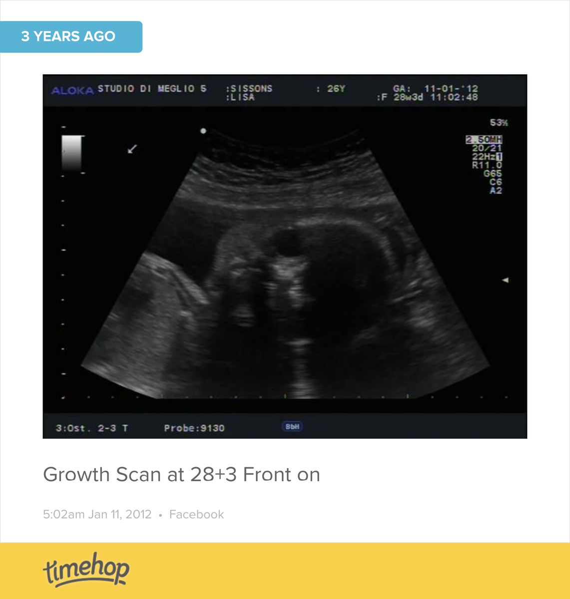 My little alien xx timehop.com/c/fup:10151133…