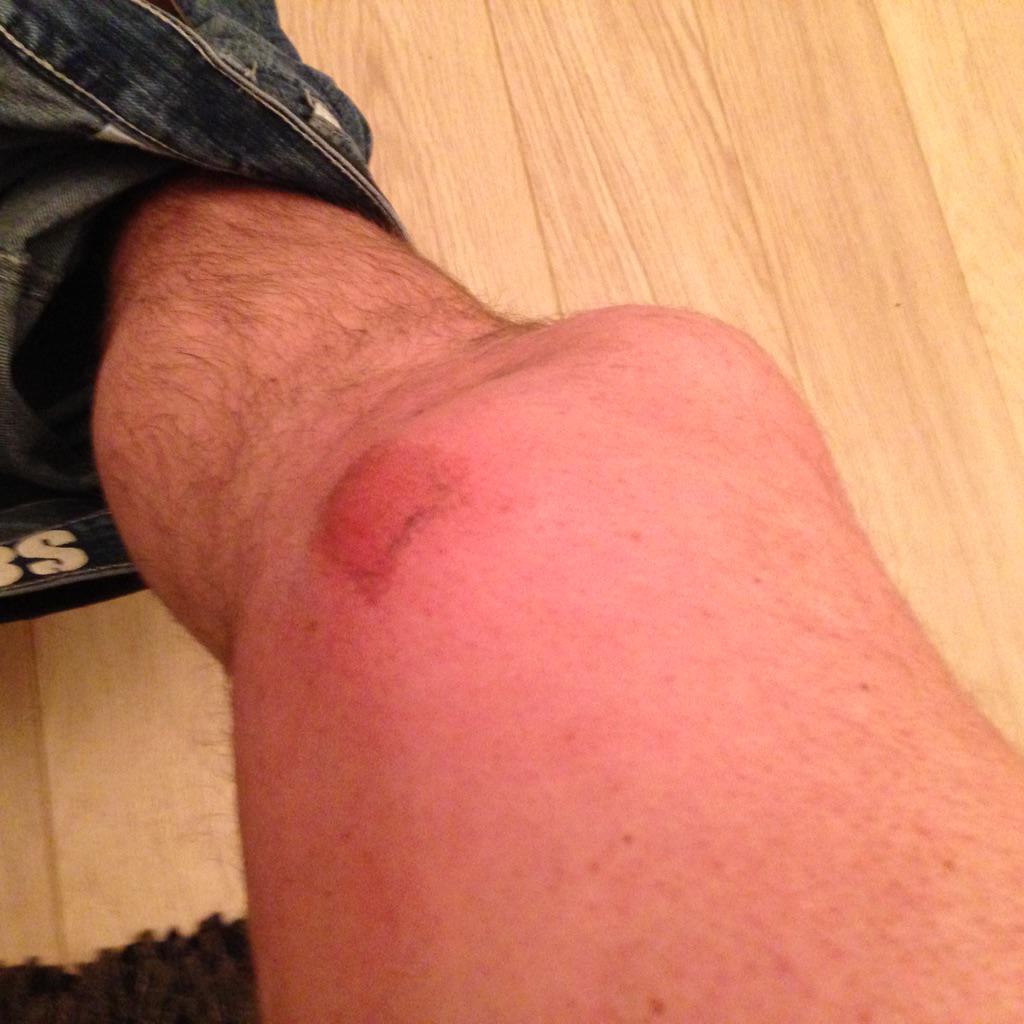 BigAlSav1's tweet photo. @HHFC_Vets @HiltonAfc still putting myself into challenges at my age!!! http://t.co/UUvbro522a