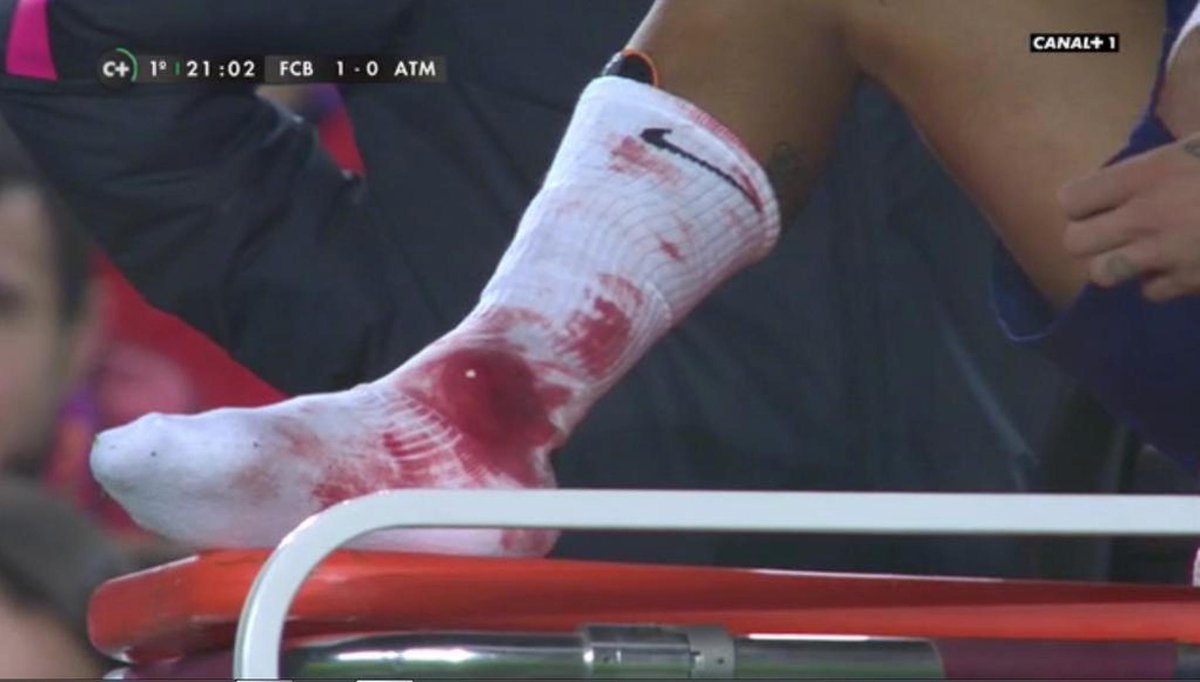 ElChirincirco's tweet photo. ¡Neymar utiliza calcetines ROJIBLANCOS! ¿Guiño al Atletico? A las 00:31:26 hablamos de su INMINENTE SALIDA. ¡VENTE! http://t.co/b9oDSGQX16