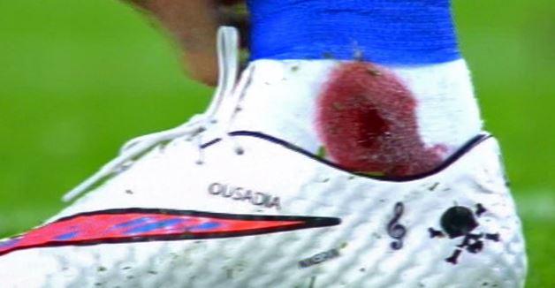 marca's tweet photo. Así quedó el tobillo de @neymarjr después de que el brasileño recibiese una entrada de Giménez http://t.co/4naskvsAk0 http://t.co/7atdEUvhDz