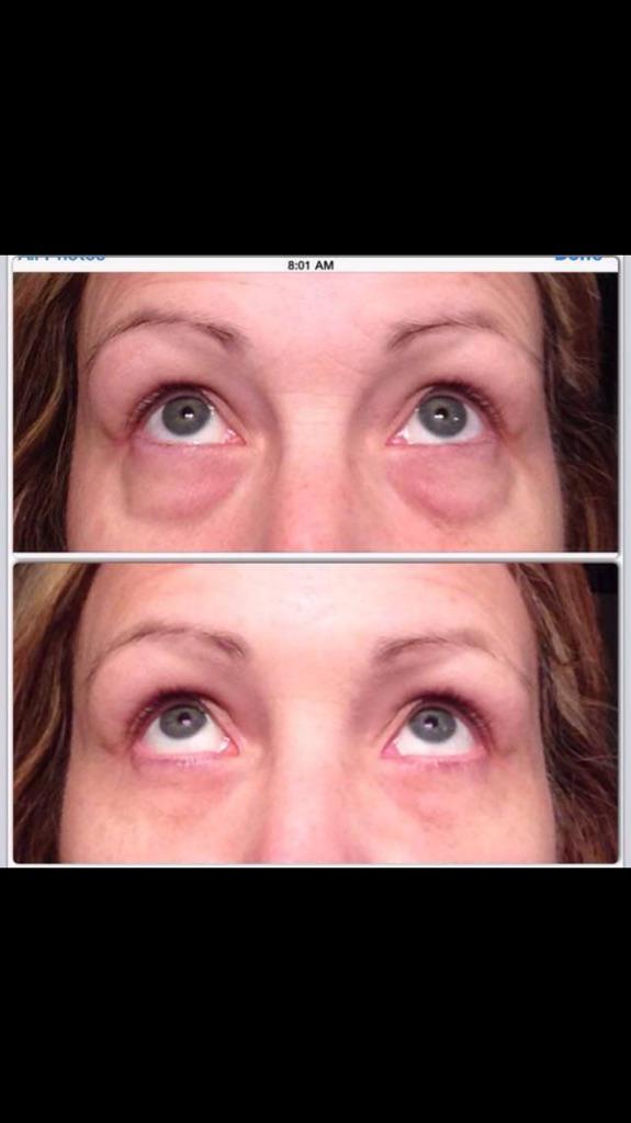 Who would like a product that can do this everyday?? #jeunesse #instantlyageless #10yearsyounger