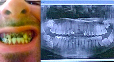 OMGgalleries's tweet photo. His Teeth Hurt So Badly He Wanted To Die, Then Something Crazy Happened http://t.co/VHrxZpDEv6 http://t.co/mb56hvOpvn