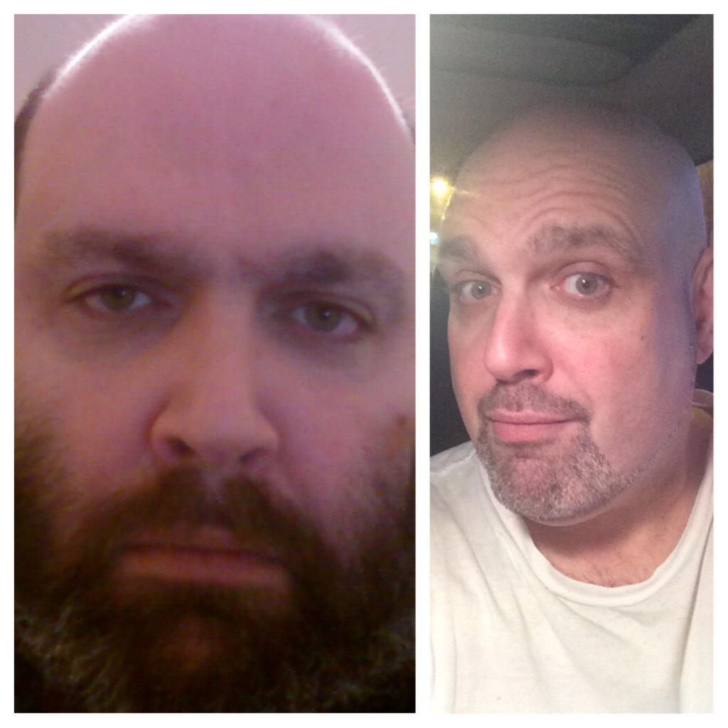 realteamtics's tweet image. What a difference in my life. The left from about 6 years ago and the right, last week. Positive attitude #teamtics