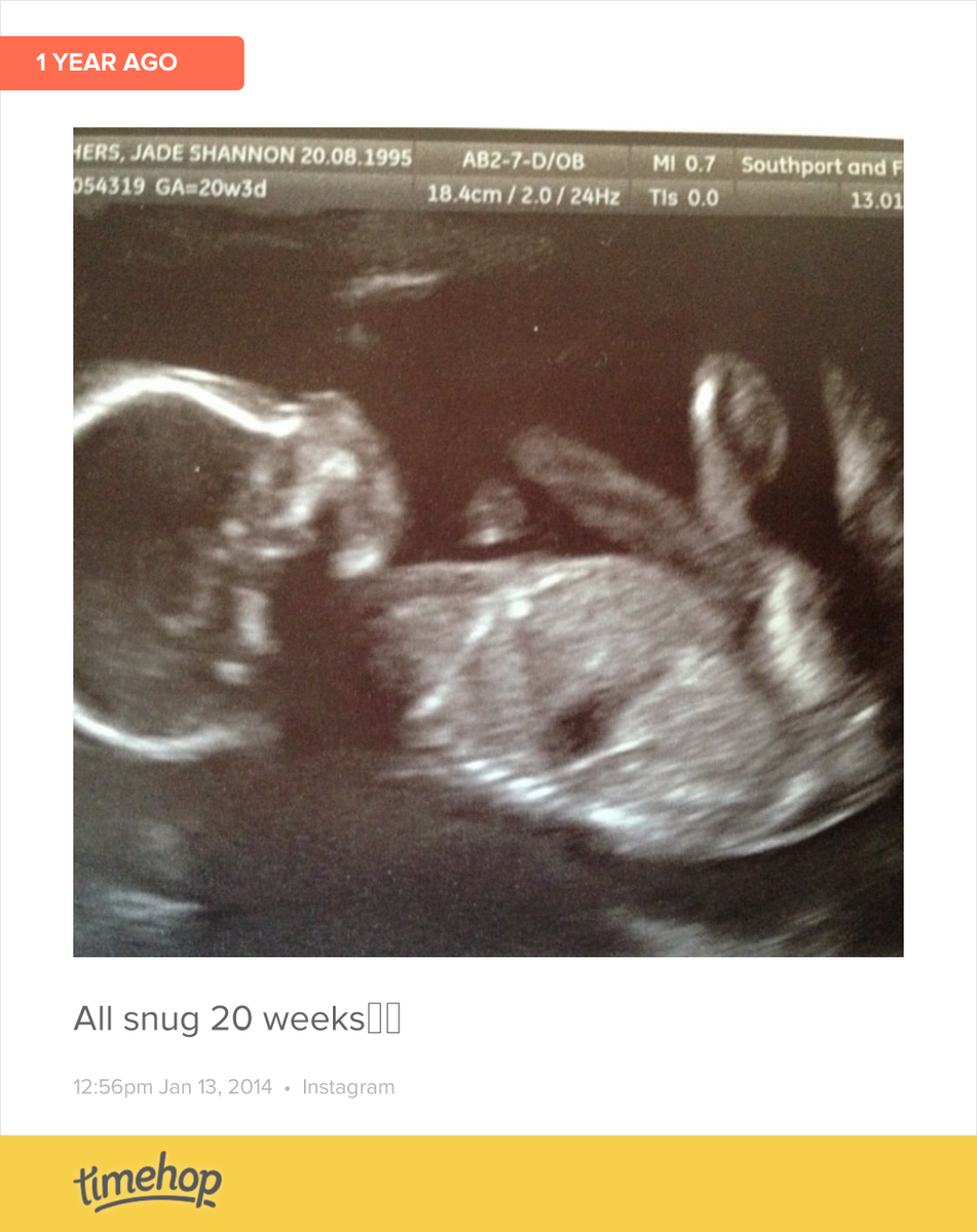 JadeBrothers_'s tweet photo. Exactly 1 year ago today! (via @timehop) http://t.co/qIcBjlW4ob http://t.co/HoMH8mYVVi