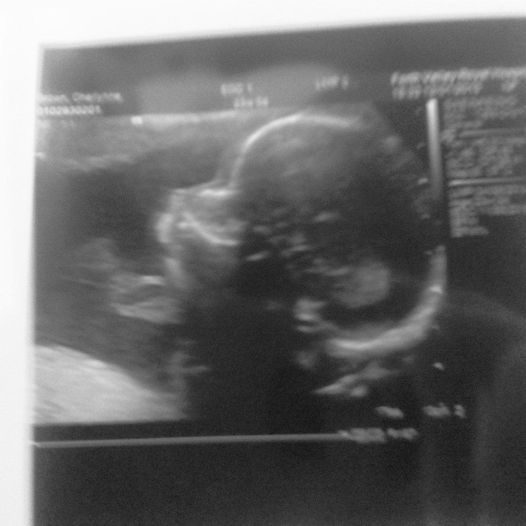 CherlynneB's tweet photo. My girl ♥♥♥♥ http://t.co/gXit0KFteg