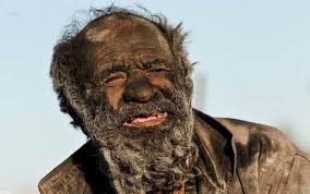 This 80 Year Old Man Has Not Taken A Bath In 60 Years. Just Wait Til You See Him… Whoa. bit.ly/1yf97xG