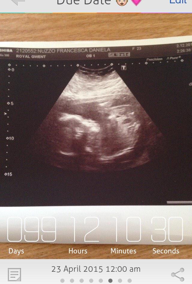 Francesca91x's tweet photo. @itvthismorning into double figures count down until baby girl arrives #HappyMap http://t.co/2upYmqoLvR