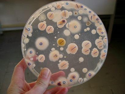 ResearchGate's tweet photo. This researcher updated over 30K public #fungi data in only 4 months. Read how: http://t.co/dVD16WlKUM #NetworkPicks http://t.co/Cy4fn4esmm