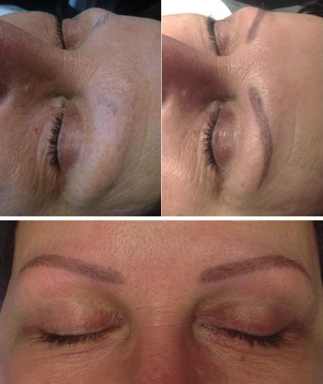 DermaGraphicsNL tweet picture