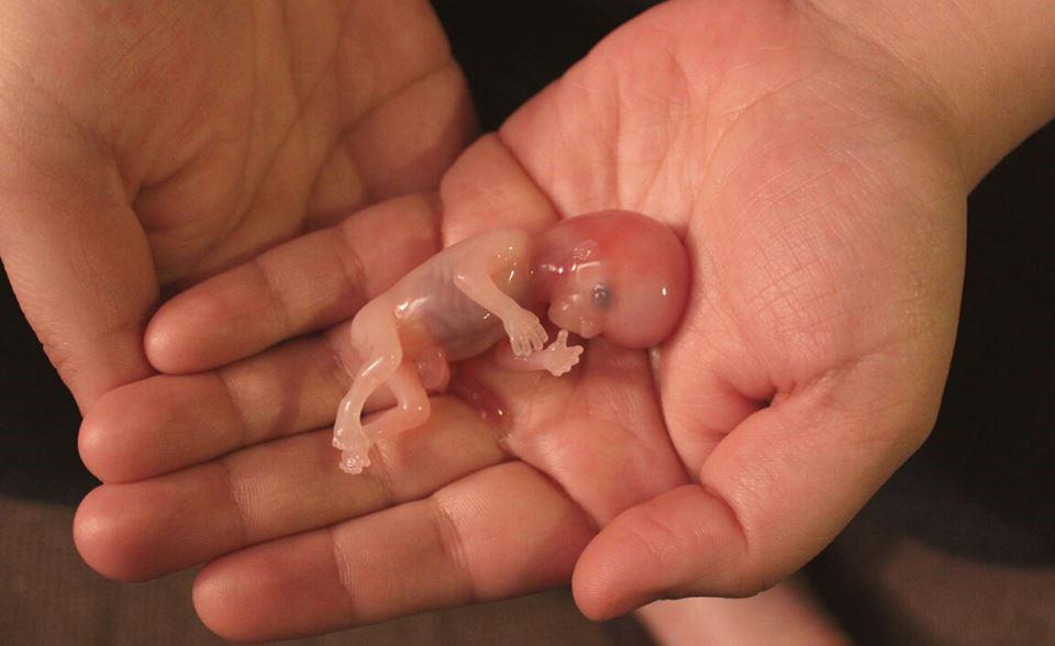derechoavivir's tweet photo. Noah nació tras 12 semanas de gestación. En España es legal matar a los no nacidos hasta la semana 14. http://t.co/pTyFHvuB8W