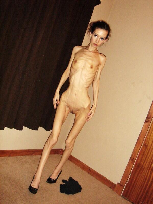 Extrem skinny pics