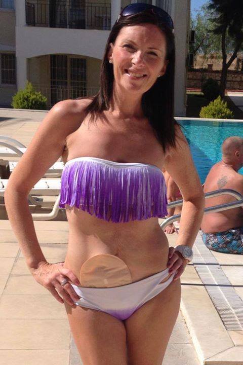 CrohnsColitisUK's tweet photo. Please read this message from #Crohns &amp; #Colitis UK supporter @Marcia0501 - http://t.co/jWoR02dzMR @tlc_uk http://t.co/LnCRnrFmfa