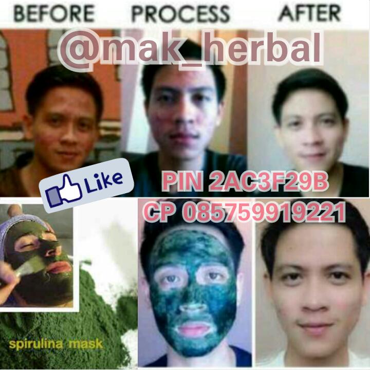 Kak @arihta16 Nih Masker FENOMENAL dr @mak_herbal  add pin 2AC3F29B ,RAHASIA KULIT PUTIH Bebas JERAWAT skrg jg!!