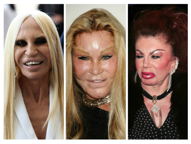 From versace to stallone and many more... when celebrity plastic