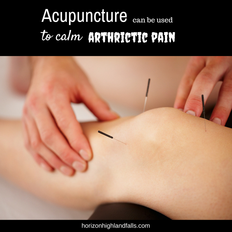 CraigAmnott's tweet photo. #Acupuncture to relieve #Arthritis and increase mobility. #AcupunctureHour http://t.co/SK15mEjmz6 http://t.co/Ha5mu6N82M