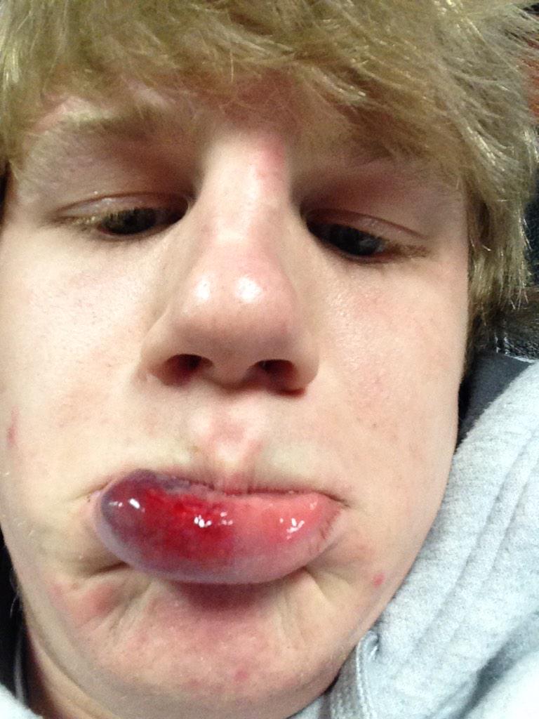 Triston Wirtjes tweet media