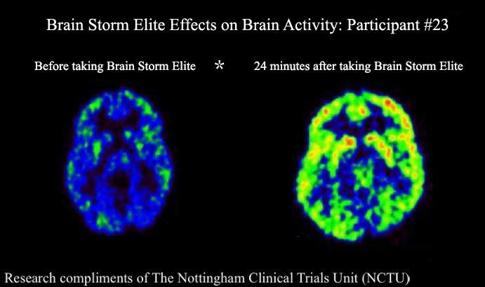 NewEra_Trends's tweet image. Breakthrough "Smart Pills" That Instantly Help With Focus. Check Them Out Here 👉 f.orbes.co/SH268