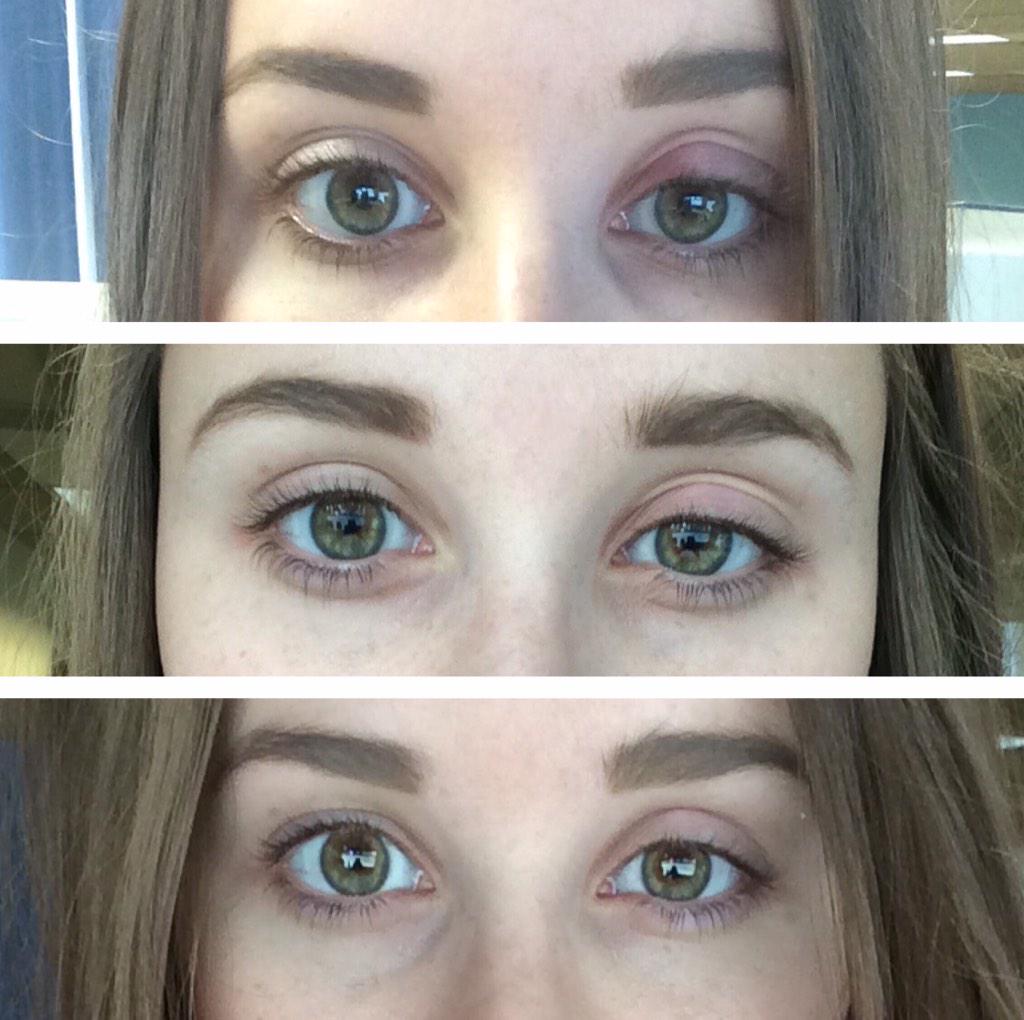 alorabuzz's tweet photo. So much progress! See you soon, contacts and eye makeup. #thouarthealing #wildbrows ๐ http://t.co/MO9zYQvgTh