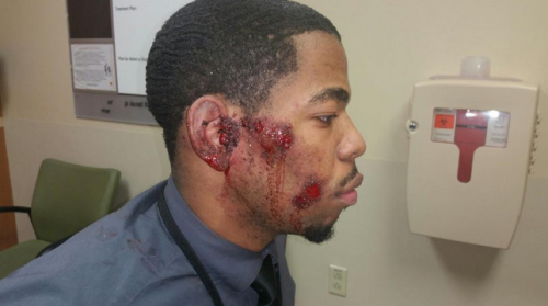 KMOV's tweet photo. St. Ann Police admitted to injuring and arresting the wrong person after a chase. http://t.co/RsEImOgo8B http://t.co/y6jtpM7kt3