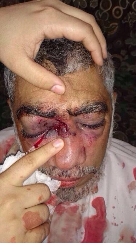 MrSatrawy's tweet photo. المعتقل الحاج #عبدالنبي_الحواج لم يخضع للرعاية الطبية لكي يتعافى من إصابته بعبوة غاز ورصاص الشوزن http://t.co/zqRV0u3VAv @racha_khalife