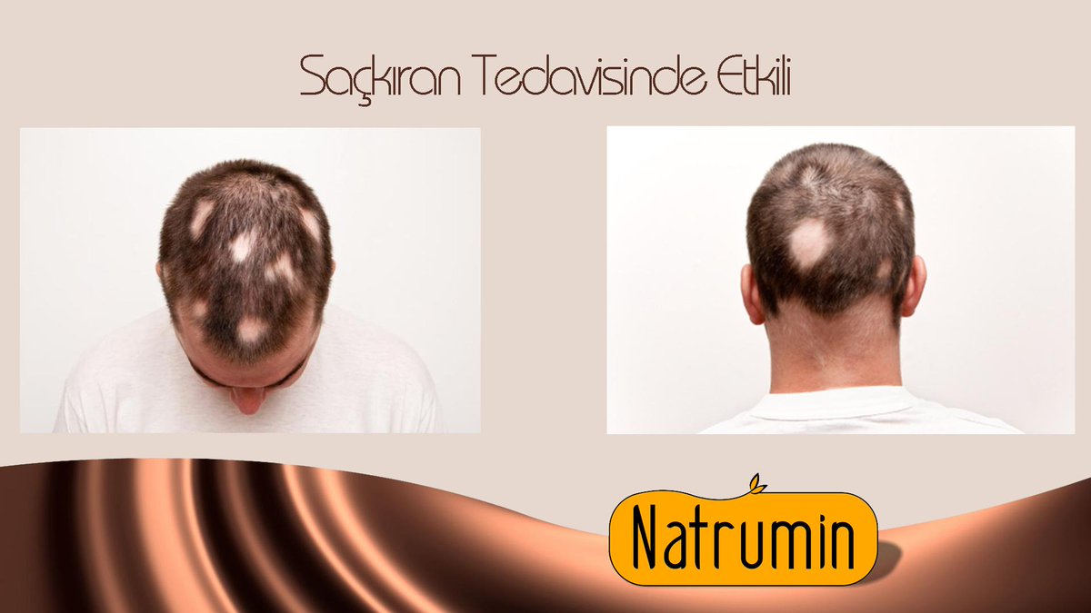endogall's tweet photo. Saçkıran(saç,sakal) sorununuz mu var?
Su Katkısız Polifenol Zengini Natrum'i Denediniz mi? 
http://t.co/AoIs4Telih 
http://t.co/a78BaHDldo