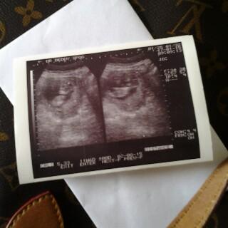 Maya_azhari11's tweet photo. Love u my sweet baby http://t.co/pdIeD6eV4o