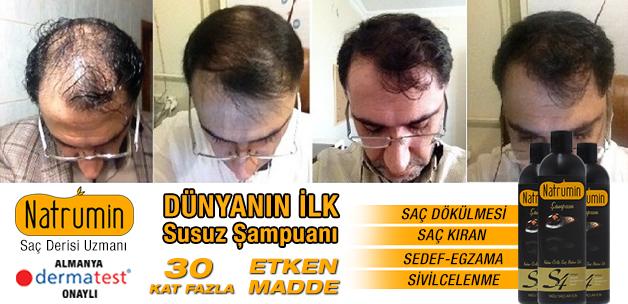 dephyto's tweet image. Natrumin Basında! Dünya da İlk ve tek su katkısız 
Saç Derisi Uzmanı. 
İlk Kullanımda etki 
natrumin.com.tr/basindan/