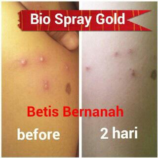 Vimala BioSprayGOLD tweet media