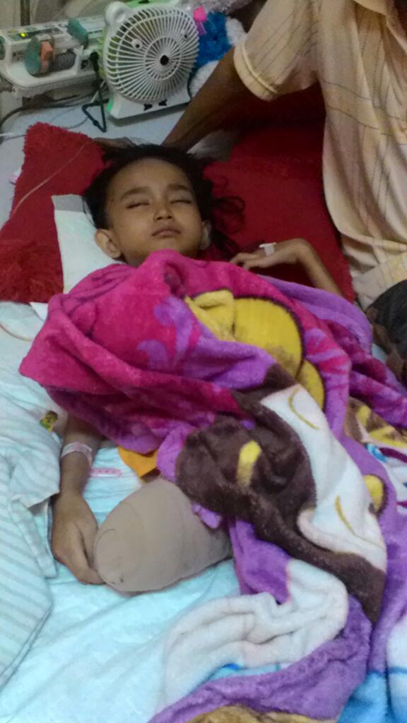 <a href="/info_pesawaran/">Info Pesawaran</a> Kondisi terakhir kalin (7 th) asal Tataan pnderita Tumor Tulang dikaki,pasca operasi amputasi diRSCM