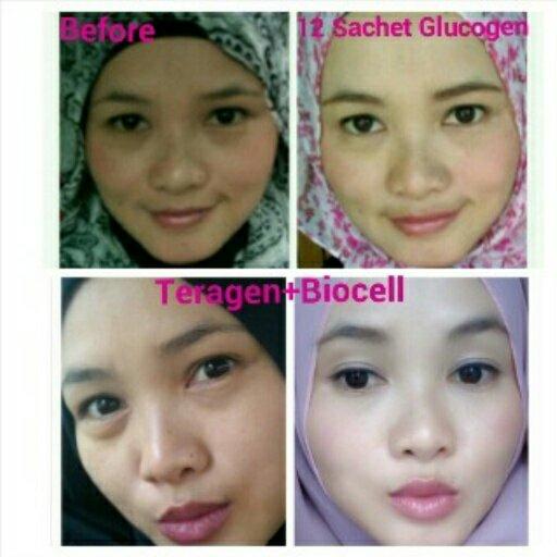 delimaberas's tweet photo. Nih putihnya alami cuma dgn GLUCOGEN. Yuk diorder
Cek bio hntuk order @Titip_Jual @Iklan_JualBeli @ForumIklanID http://t.co/BaoPzszlRN
