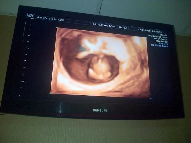 Ini anak kita sayang <a href="/ochaasiscaa/">Siska Nurma Utami</a>