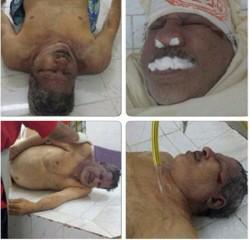 AlBiladii's tweet photo. صور إلى #الشهيد_عبدالعزيز_السعيد وهو على المغتسل بعد قتله بالغازات القاتلة على يد عصابات الإجرام الخليفية #البحرين http://t.co/6DeotiMtmS
