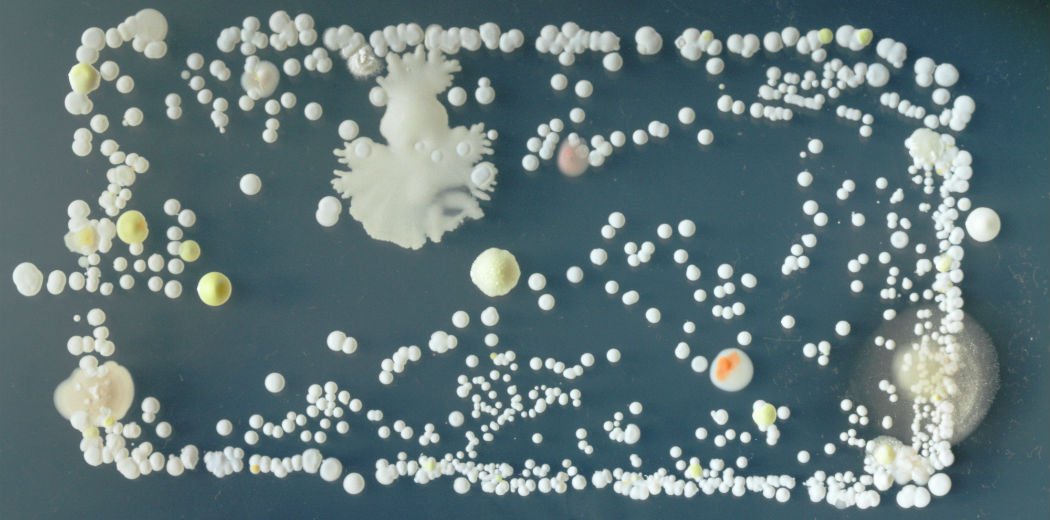ScienceAlert's tweet photo. Here's what's growing on your smartphone screen: http://t.co/3lK7JQdgMd http://t.co/ZtYLGxcjZt