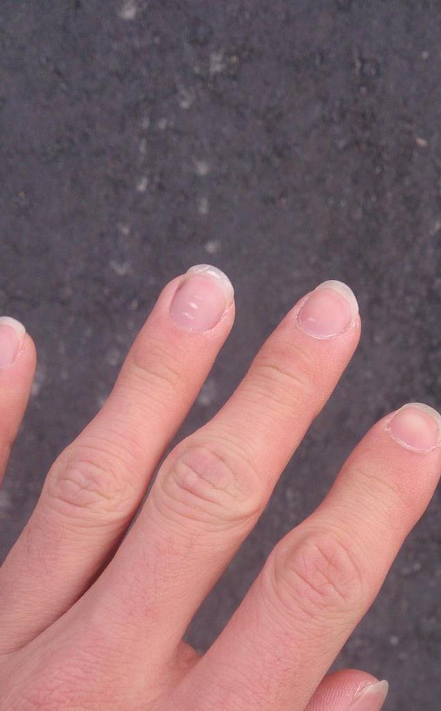 縺翫 繝 縺ｿ繝 繧ｷ繧 繝ｳ V Twitter Yakkuru222 簡単に説明しますと 綺麗な手はスポーツマンの手で爪まで綺麗なのが音ゲーマーの手でございます ちなみに私の手は肌が荒れ 特に薬指辺りの爪が白い点 ヒビ 内出血でカオスです これがアホ音ゲー廃の手です