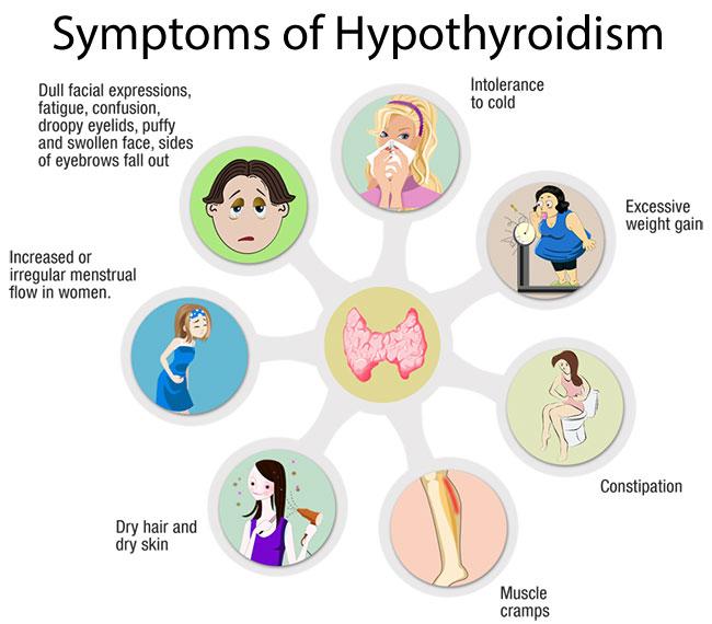 doctor Suggested Treatment For hypothyroidism health tips doctor-suggested-treatment-for-hypothyroidism-health-tips