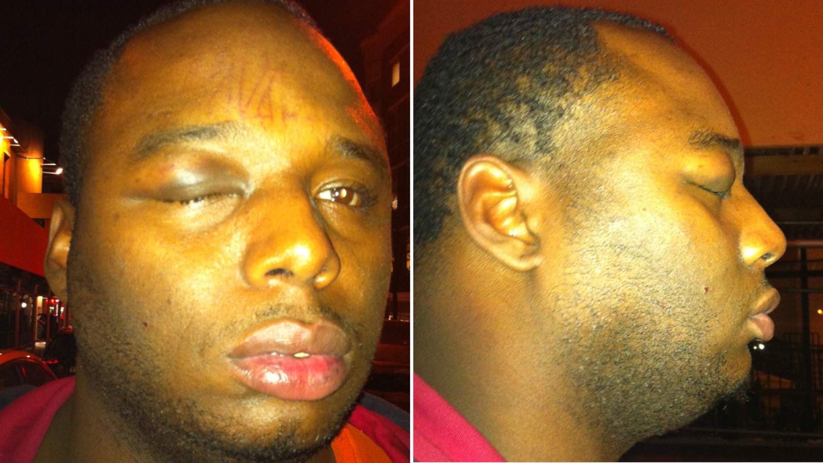 Sky News on Twitter "A New York City man placed in a choke hold by