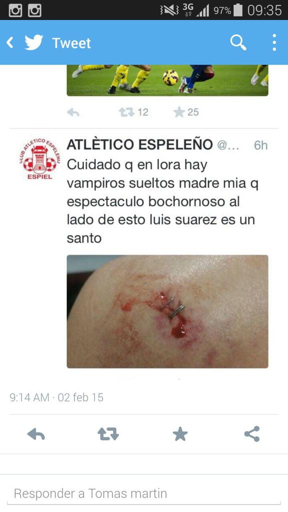 Maxima difusion para esto.Tenemos a nuestro jugador en el hospital y @AtcoEspiel se dedica a insultarnos. <a href="/DLoracf/">loracf</a>