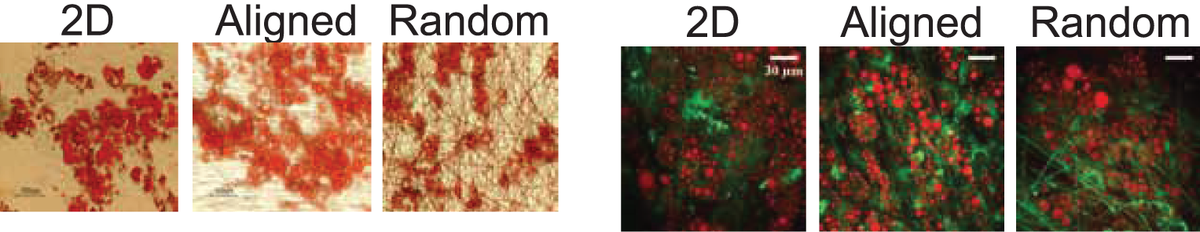 NanoSol's tweet photo. Human AdiposeDerived #stemcells on electrospun fibers show Increased Adipogenesis #cellculture http://t.co/2k3lHNrRNM http://t.co/giq7qDs4wQ