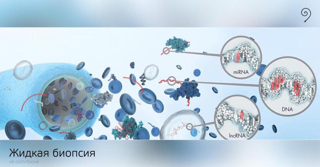 трепан биопсия молочной железы. биопсия раковые клетки. чрескожная пункционная биопсия печени. тонкоигольная биопсия молочной железы. аспирационная биопсия молочной железы.