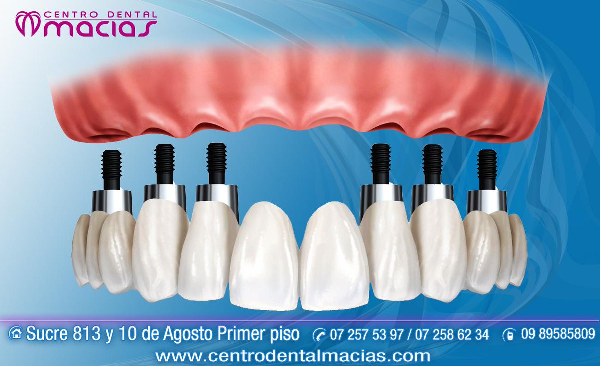 recuerden: mantener una adecuada limpieza diaria de nuestros dientes usando hilo dental y enjuague bucal.