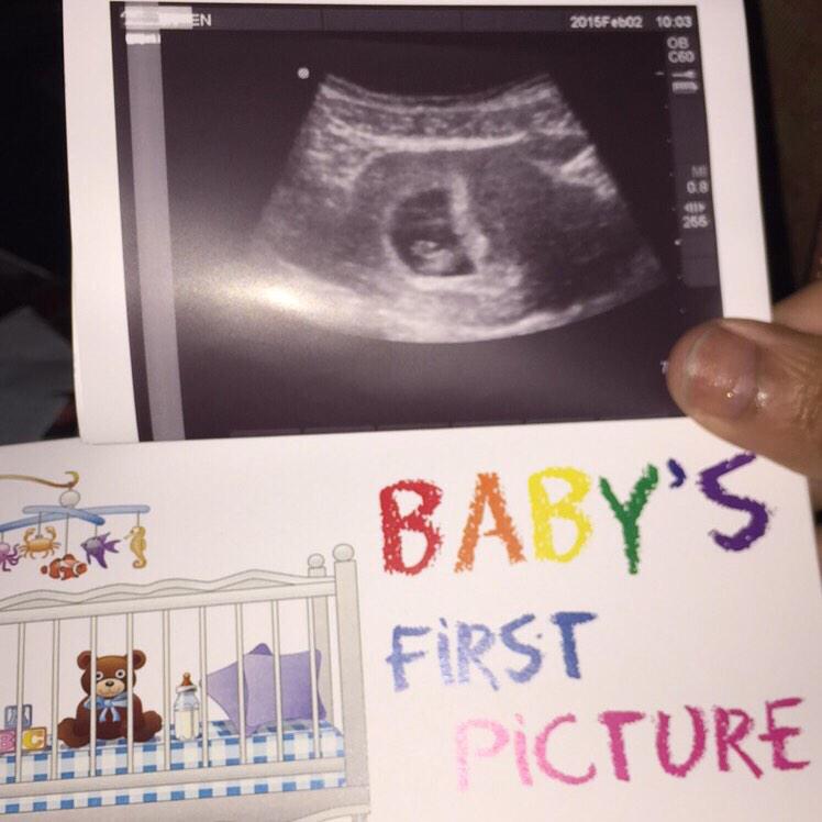 Carmennkayy's tweet photo. Oh yeah, this happend today #10Weeks #DoesntEvenLookHuman #FirstBabyPicture #BabyDye @KiddRockit #September6 💙💕👼😻😻 . http://t.co/Zp0W5LjZ9b